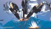 робототехника в хирургии